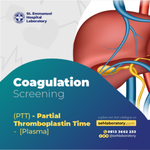 (PTT) - Partial Thromboplastin Time - [Plasma]