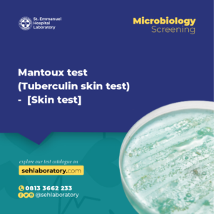 Mantoux test (Tuberculin skin test) - [Skin test]